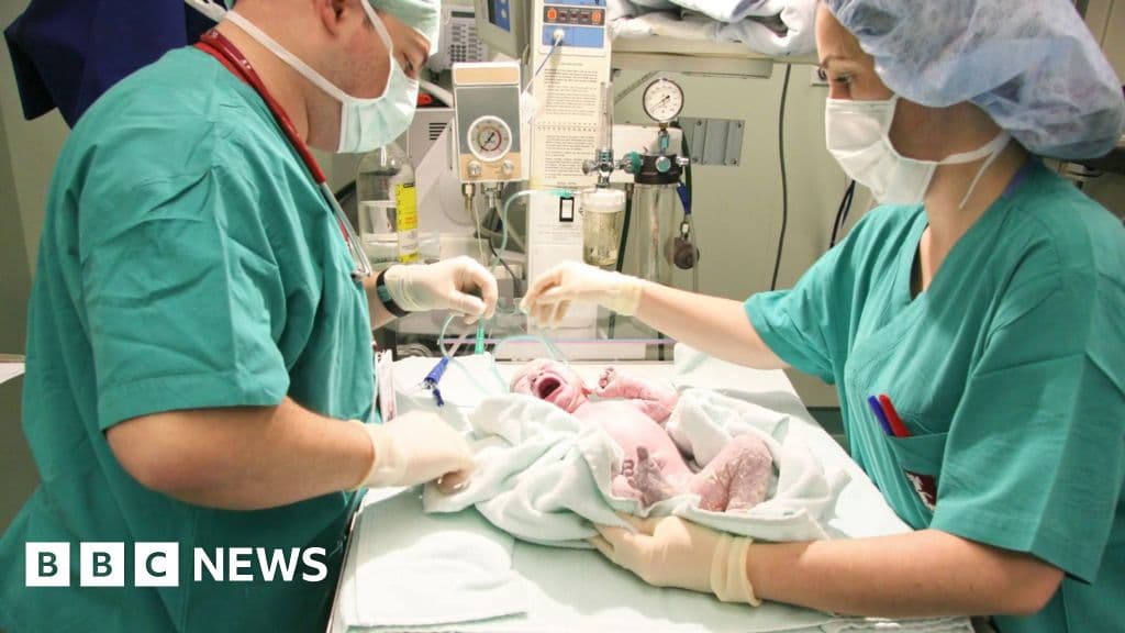 One in four births in England is now emergency caesarean, BBC analysis shows